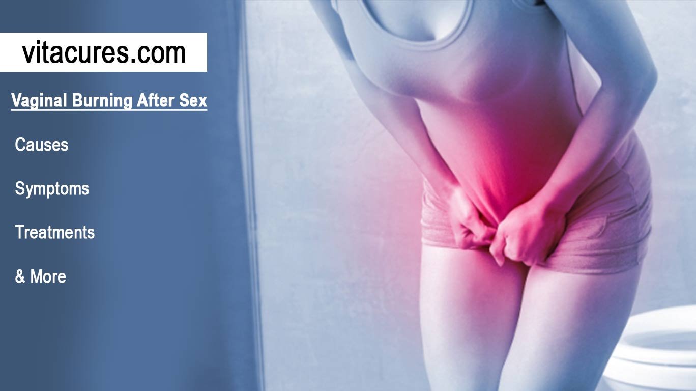 vaginal-burning-after-sex