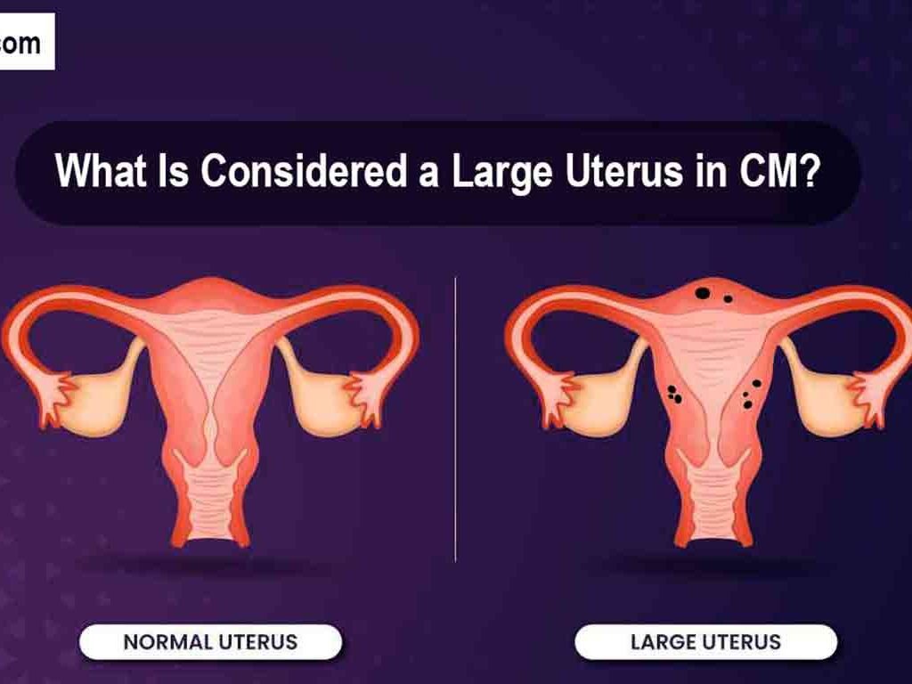 Large Uterus